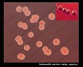 salmonella enterica